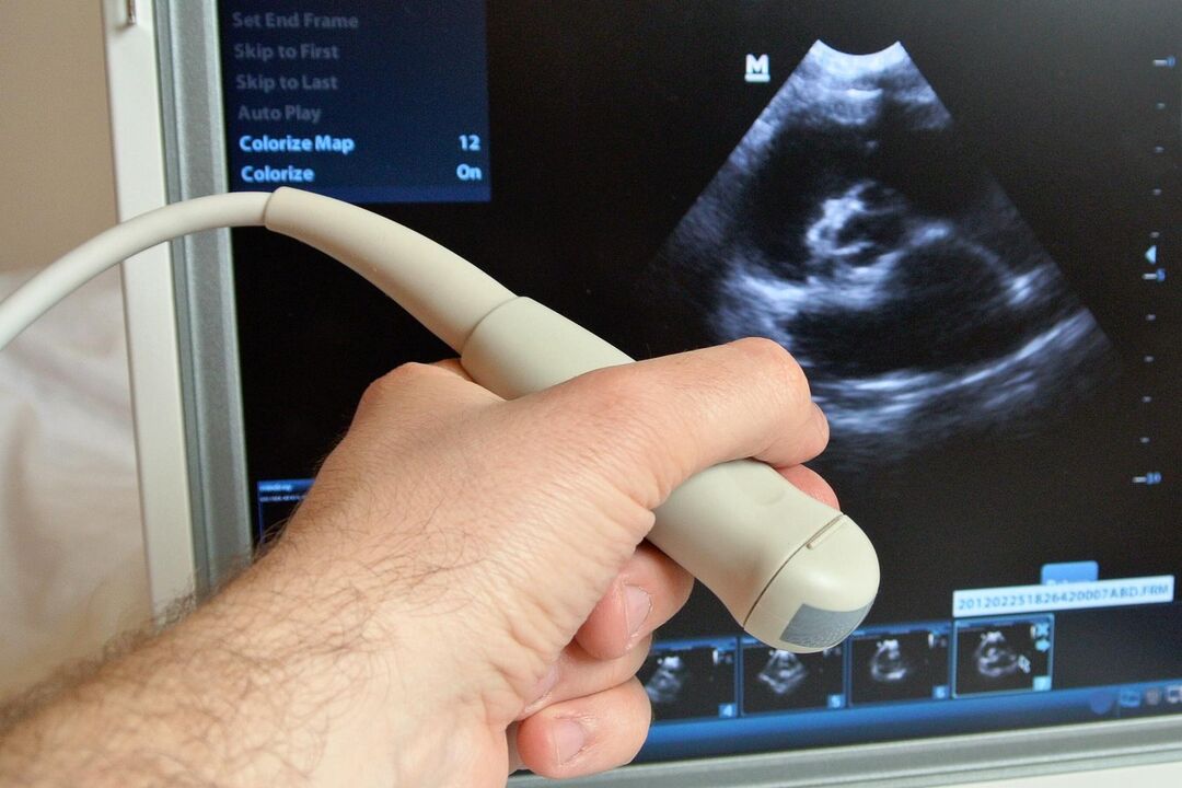 Ultrasound helps diagnose congestive prostatitis in a man